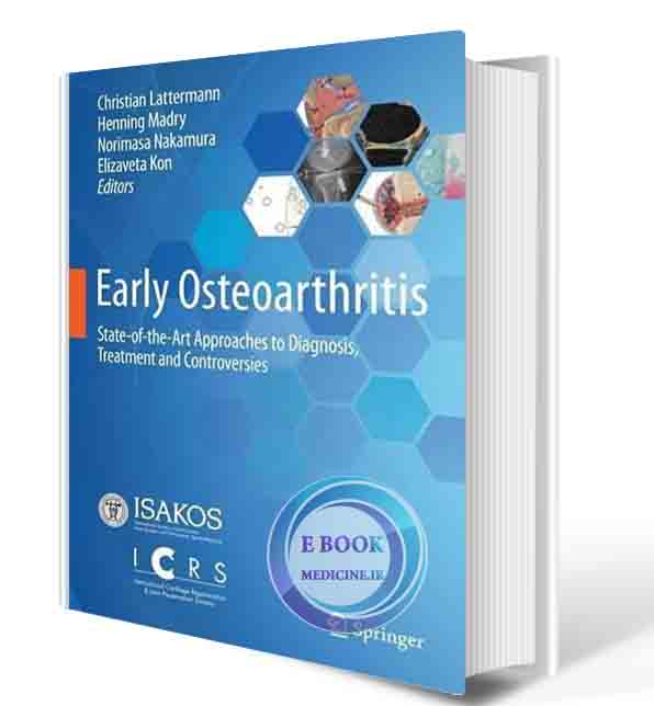 دانلود کتاب Early Osteoarthritis: State-of-the-Art Approaches to Diagnosis, Treatment and Controversies 1st ed. 2022 (ORIGINAL PDF)